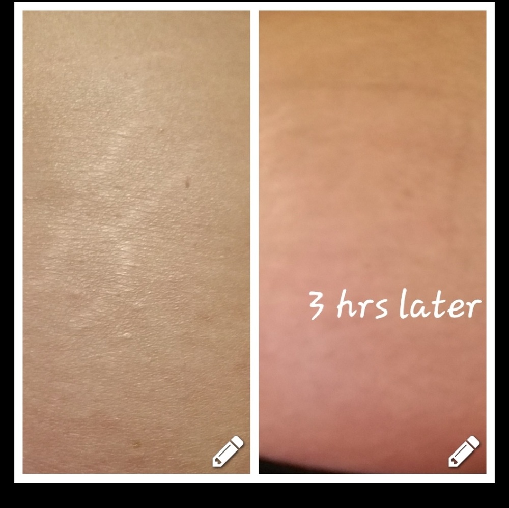 Skin care